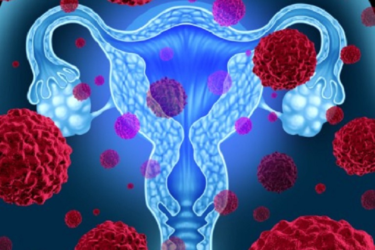 HPVってなあに？