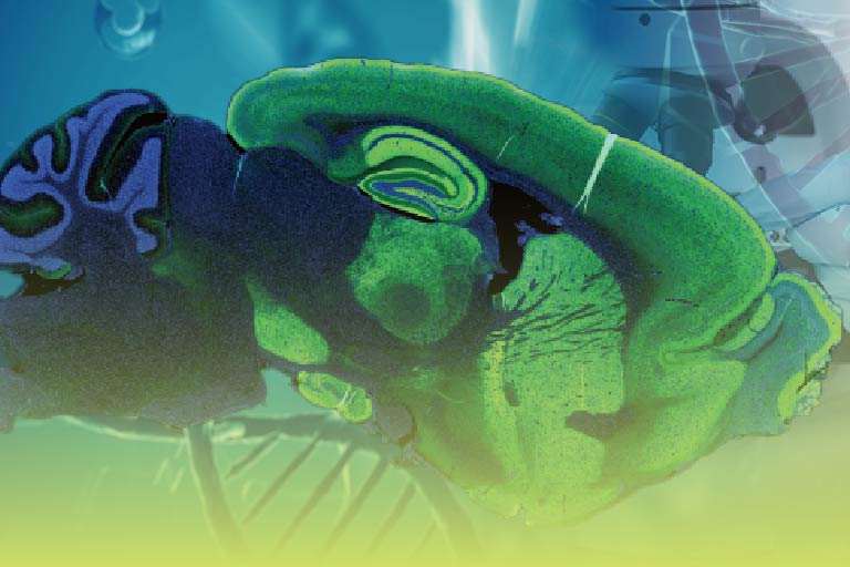 空間トランスクリプトーム受託サービス