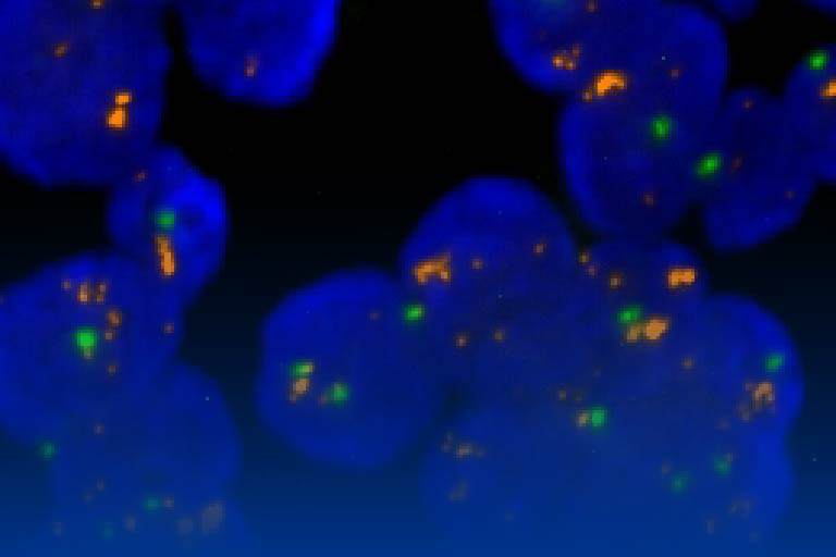 蛍光 in situ ハイブリダイゼーションDNA-FISH