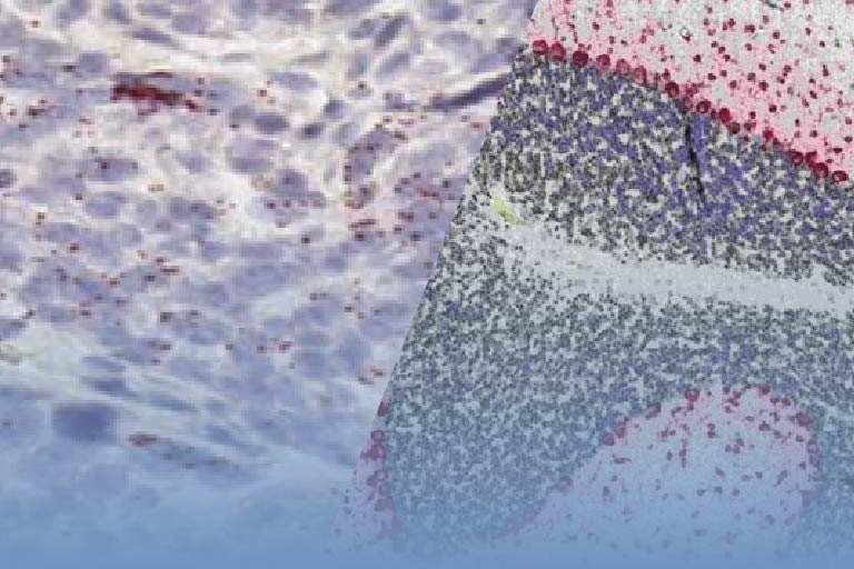 in situ ハイブリダイゼーション ISH, FISH(mRNA, DNA)