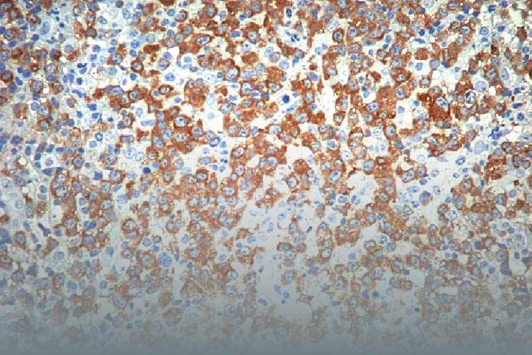 免疫組織化学染色（ IHC ）