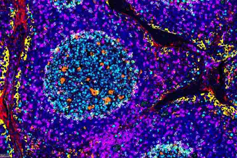 蛍光多重免疫染色