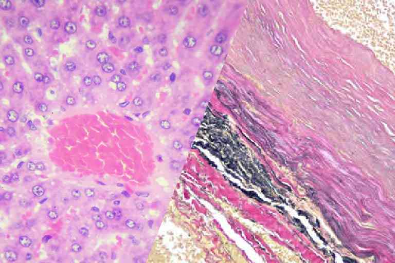 HE染色・特殊染色
